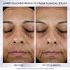 Anti-Ageing Regenerative Cream Lancôme Rénérgie Lift Ultra 50 ml